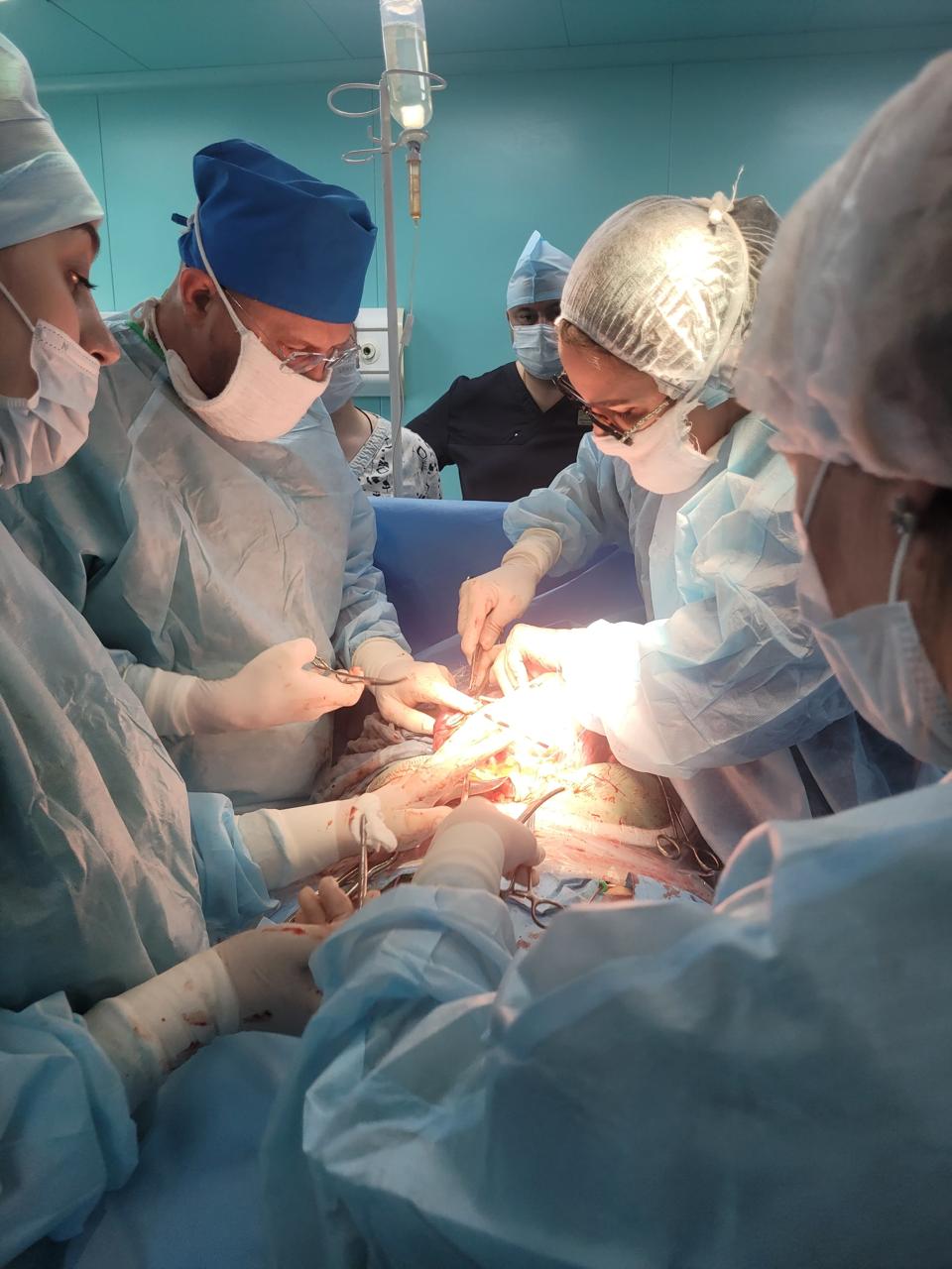 В Перинатальном центре Крыма уникальная операция спасла жизнь матери и ребенку при редкой патологии беременности